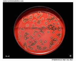 streptococcus equi colonies on blood agar plate